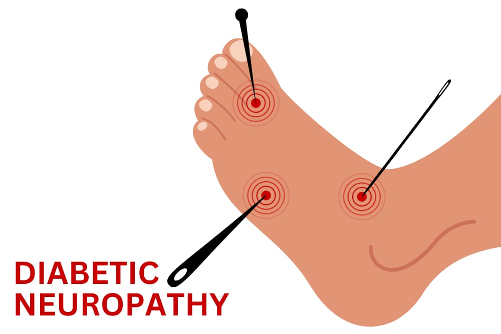 Diabetic Neuropathy Profile